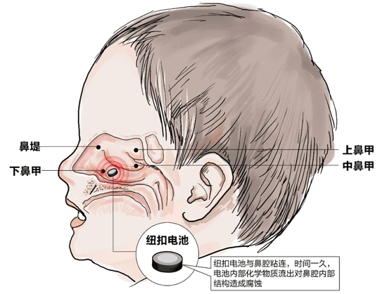 上海發(fā)布兒童電子產(chǎn)品風(fēng)險(xiǎn)預(yù)警 部分存在電池吞咽風(fēng)險(xiǎn)